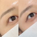 이준뷰티 | 강남/신논현 내돈내산 속눈썹펌 추천! [화인뷰티]클리닉펌 후기 + 속눈썹영양제