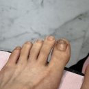 네일또오나&내성발톱 김포풍무 본점 | 풍무동네일 김규희뷰티네일 사우동네일 내성발톱젤네일 후기