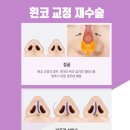 윌성형외과