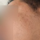 화성한방병원 | 화성한방병원 울트라클리어 내돈내산 2회차 효과 만족후기