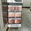 ⁞⁞ 예지미스킨앤바디 ⁞⁞ 천안피부샵 백석동 윤곽 경락 웨딩케어 솔직후기