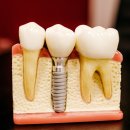 밝은e치과의원 이미지