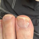 푸스케어 수원호매실점 | 영통 내성발톱 발톱관리 '푸스케어 수원영통점'