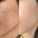 가하프라자 | [경기] 다산피부관리 여드름관리 스킨케어 왁싱샵 속눈썹펌 , 블랑 스킨 &amp; 케어
