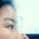 안면분식