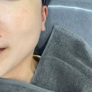 제이메디컬 | 대구 피부관리 제이스킨, 압출 수분 각질관리 메디컬 스킨케어 후기