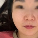 와이에스네일