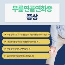 삼성마디탑정형외과의원 | 야탑정형외과 계단을 오르내릴 때 무릎 앞쪽이 아프다면, 연골연화증