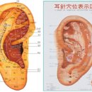 우측 안면 마비(구완와사) 증상 자석건강요법 치료 사례 이미지