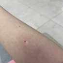 광팔이 | [#15. 쌍각자궁, 남들과 조금 다른 임신 기록, 후기 III ]