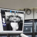 임플라인치과의원 | 치아노트로 임플라인 치과 스케일링 내돈내산 후기