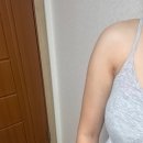 강남연세라인의원 | 10. 내돈내산 마른 비만의 팔뚝살 지방흡입 1달차 후기 / 강남 로얄 라인의원