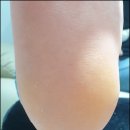 더케어(The Care) 이미지