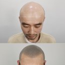 리게인프로젝트 이미지