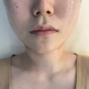 다미인피부비만관리 | 피부미용창업 노원 다미인 피부미용기기 데모 후기