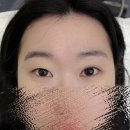 봉곡동135 | 창원 도계동속눈썹펌 |무쌍·짝눈 고민 고객님| 속눈썹펌 후 눈매 변화 후기