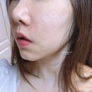 (주)나노메디칼 | 엑소프록실 시카 앰플 :: 수분 세럼으로 가볍게 바르자~