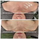 오행한의원 | 은평구 피부관리 '셀럽뷰티어겐' | 대조동 윤곽관리의 화타를 만나다. (수승화강+화사 mts)