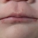 유하메디칼 이미지