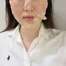 구로 끗한의원 | 구로 끗 한의원 방문 후기 - 점제거 추천과 아쉬운점