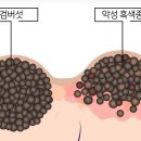엄마손한의원 네이버블로그
