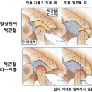 턱편한세민치과 네이버블로그
