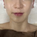 주엽피부관리, 속건조 홍조 관리 라폿에스테틱 피부재건필 후기