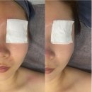 김나연스킨케어 네이버블로그