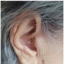 포낙보청기 강동센터 이미지