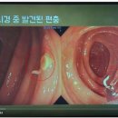 동산내과 네이버블로그