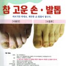 참고운약국 네이버블로그