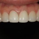 여치과기공소 이미지