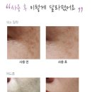 더마 리바이브