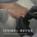 레푸스계양구청점