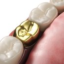 크라운치과보철과치과의원 이미지