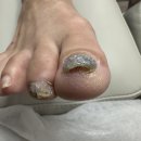 푸스케어 파주운정점(라푼젤네일) | 파주네일 발톱관리 잘하는 라푼젤네일 푸스케어 파주운정점!
