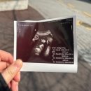 (주)빈오너스 | 임신34주차｜2.5kg 아기와 자연분만 고민 중인 나