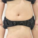 ㈜분당제일에너지 | 서현피부관리 메스티 분당서현점 다이아테라피 후기