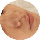 의정부 피부관리 [스킨뮤즈]에서 아쿠아필 후기