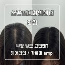 스칼프디자인센터 | 인천 탈모 커버 - 스칼프 디자인센터 최종 후기