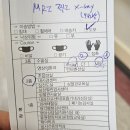 양성곰탕 | [30대 유방암 일기] MRI CT검사, 7차 도세탁셀 TC항암, 안산고대병원 일반병동4인실 입원 후기