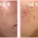 피디티 이미지