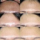포항공대 카피센터 | 노바덤 펩타이드 3종 OPEN - 피부장벽, 트러블, 가려움증 개선