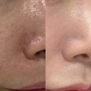한스피부미용센터 | 구미 피부과 추천 🍃 든든한방병원 부설 클라비에 피부미용센터 솔직후기 (내돈내산)