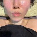 제일특수 | 특수윤곽관리 용인에스테틱 티나테라피재방문후기