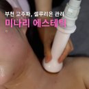 바이오밸리길 | 부천시청역 피부관리 미나리에스테틱 셀룰리온 고주파로 이중턱 지방흡입 바이오본드 관리한 후기