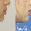 플러스덴치과의원 네이버블로그