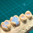 설 치과기공소 이미지