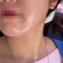 광주 화정동ㅣ꼼꼼한 스킨케어 '온유스킨' 솔직 후기(주차정보O)