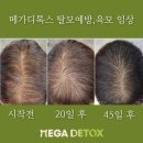 (주)메가디톡스